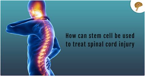 How Can Stem Cell Be Used to Treat Spinal Cord Injury? - NeuroGenBSI