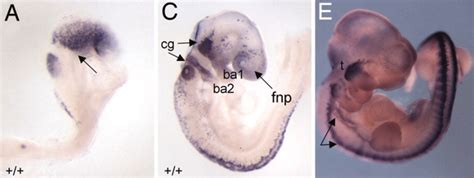 Filemouse Head Neural Crest 01 Embryology