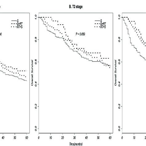 Survival Curves Of Neo Adjuvant Radiotherapy To Eac Patient Based On Download Scientific