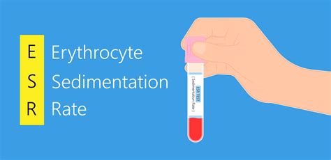 Erythrocyte Sedimentation Rate (ESR)