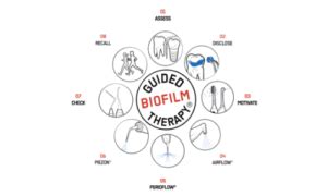 Guided Biofilm Therapy Aka Air Polishing Prairie Village Dentists