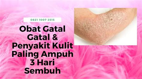 Obat Gatal Gatal And Penyakit Kulit Paling Ampuh 3 Hari Sembuh Youtube