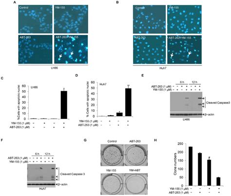 Ym Sensitizes Abt Induced Apoptosis In Hcc Cells A Lh And