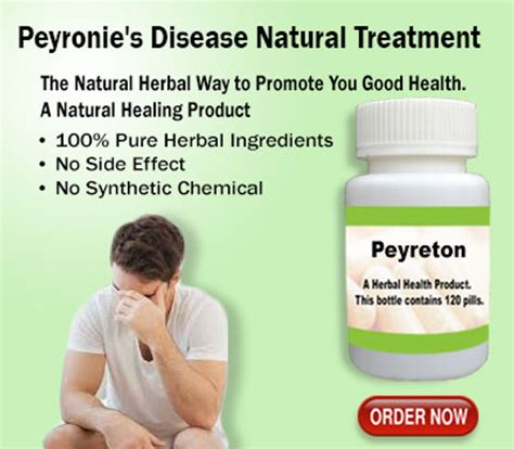 Natural Remedies For Peyronie’s Disease Symptoms Causes And Treatment