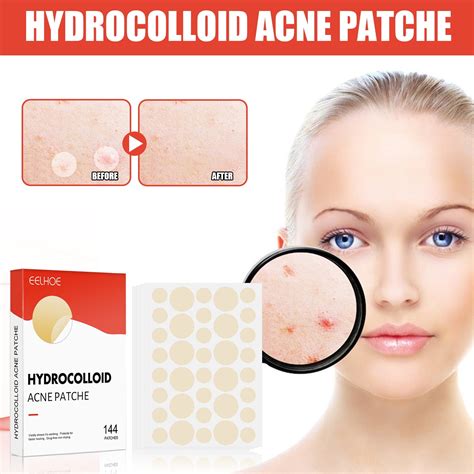 Acne Patches144pcs Invisible Hydrocolloid Pimple Patches Acne Dots