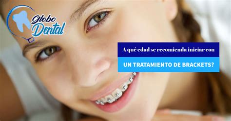 A Qu Edad Se Recomienda Iniciar Con Un Tratamiento De Brackets