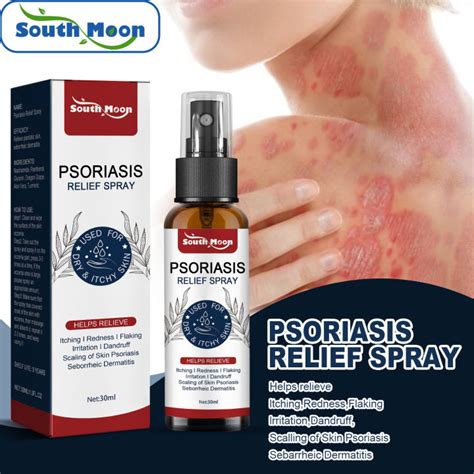 South Moon Xịt Điều Trị Vảy Nến Da Mặt Ức Chế Mảng Vảy Da Tay Chân Da Đầu Eczema Tinea Chống