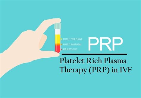 Platelet Rich Plasma Therapy Prp In Ivf Dr Shivani Sachdev Gour