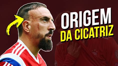 A Triste Origem Da Cicatriz De RibÉry Youtube