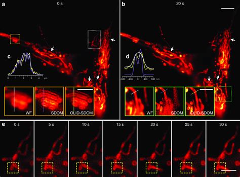 Dynamic Super Resolution Live Imaging Of TOM20 GFP Labeled Mitochondria