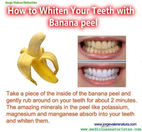 20 Banana Peel Uses | Pioneering The Simple Life