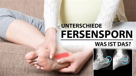 Fersensporn Ursachen Diagnose Schmerzen Vorbeugen Youtube