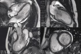 Training In Cardiovascular Magnetic Resonance Scmr Guideline