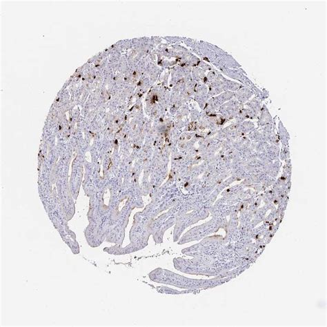 Tissue Expression Of Chga Staining In Stomach The Human Protein Atlas