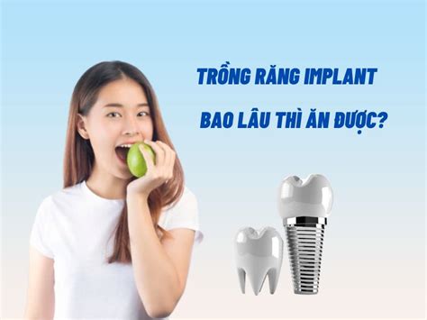 Tr Ng R Ng Implant Bao L U Th N C N N N V Ki Ng G