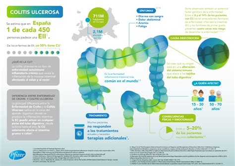 La Prevalencia De Colitis Ulcerosa Es Tres Veces Superior A La Estimada