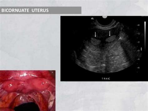 Basic gynae ultrasound