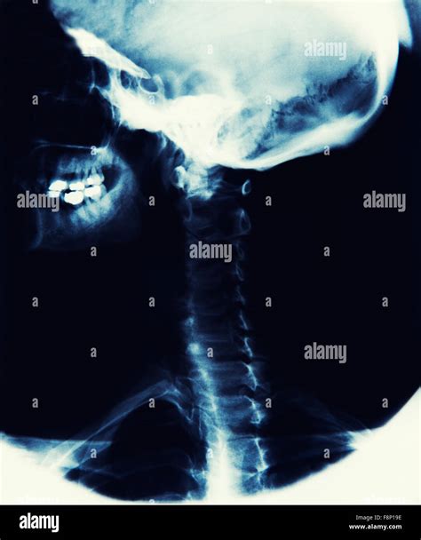 Cráneo de la columna vertebral fotografías e imágenes de alta