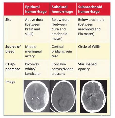 Types Of Brain Hemorrhage MEDizzy