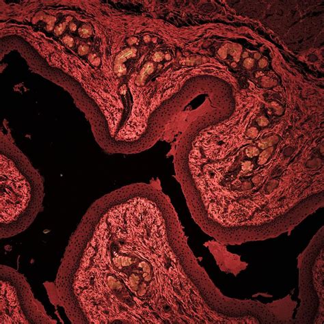 Squamous Epithelium Photograph By Science Photo Library