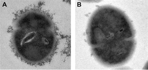 Pdf Novel Clues On The Specific Association Of Streptococcus