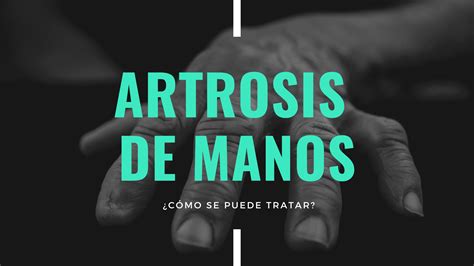 Soluci N Para La Artrosis De Manos Dr F Lix L Pez Traumat Logo En