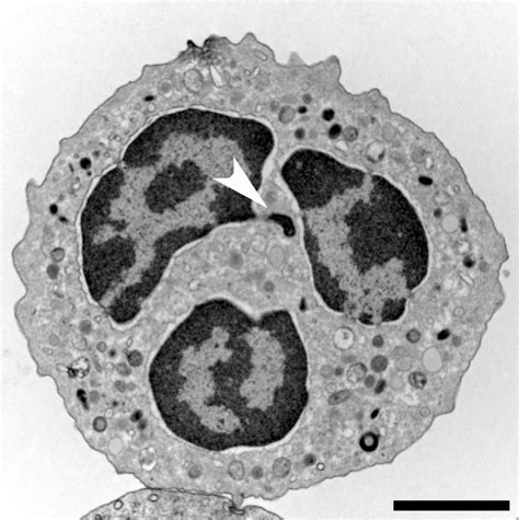 Figure 1 From Neutrophil Extracellular Traps Is Immunity The Second Function Of Chromatin