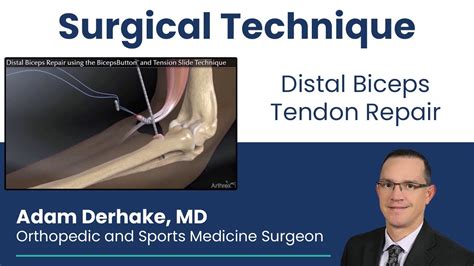 Distal Biceps Tendon Repair Surgical Technique YouTube