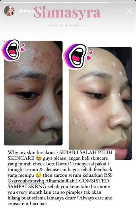 ZARZOU SERUM On Twitter Produk Serum Kesayangan Orang Ramai ZARZOU