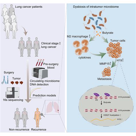 Intratumor Microbiome Derived Butyrate Promotes Lung Cancer Metastasis