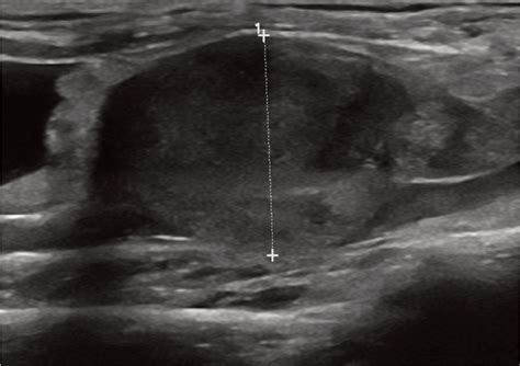 Feline Abdominal Ultrasonography Whats Normal Whats Abnormal Abdominal Lymph Nodes