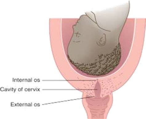 Maternal Newborn Intrapartum Care Flashcards Quizlet