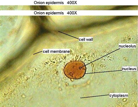 Onion Epidermal Cell Under Microscope Labeled At Jordan Judah Blog