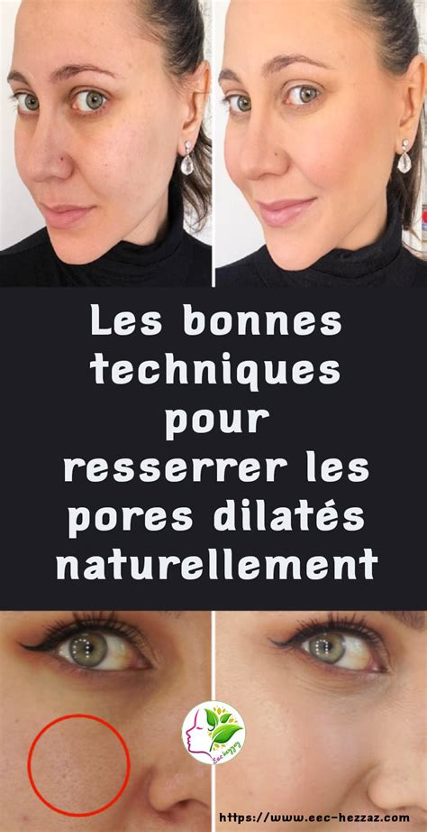 Les Bonnes Techniques Pour Resserrer Les Pores Dilatés Naturellement