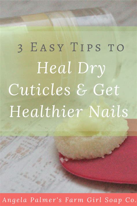 3 Easy Tips To Heal Dry Cuticles And Get Healthier Nails Dry Cuticles