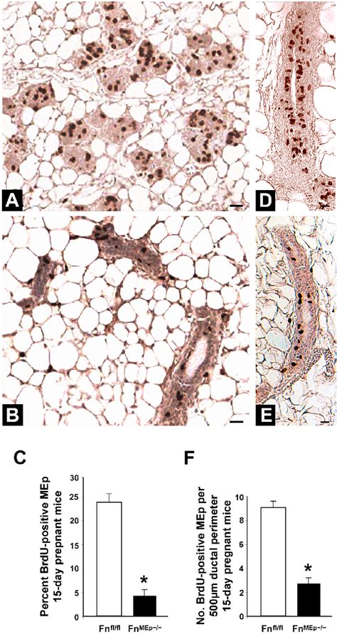 Figure 1 From Conditional Knockout Of Fibronectin Abrogates Mouse