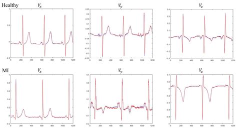 Sensors Free Full Text Automatic Classification Of Myocardial