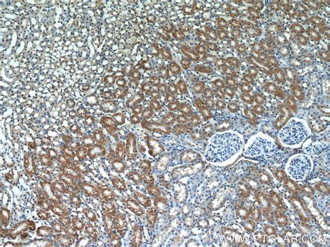 SEPX1 antibody 15333 1 AP Proteintech 武汉三鹰生物技术有限公司