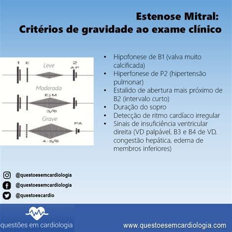 Estenose Mitral critérios de gravidade ao exame físico