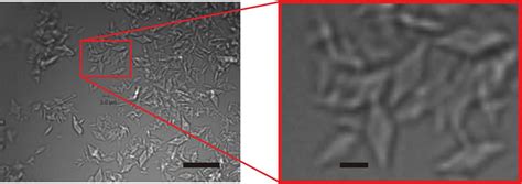 IUCr Microcrystal Preparation For Serial Femtosecond X Ray