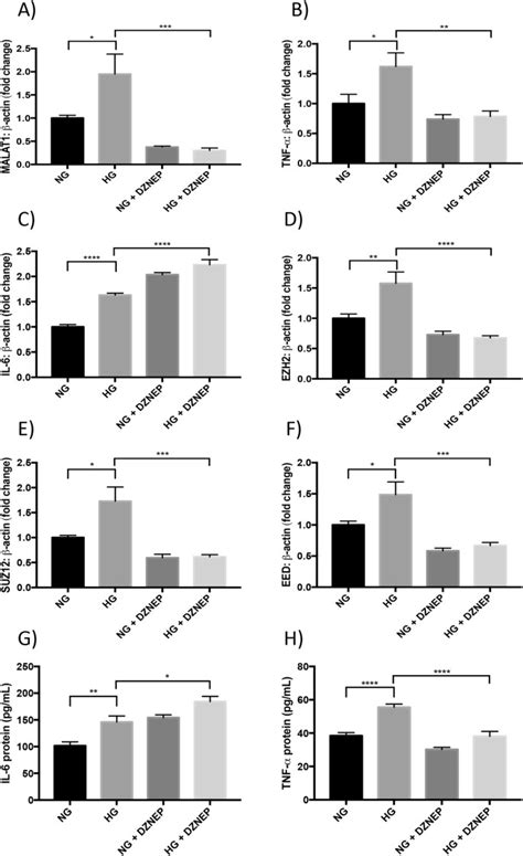 MALAT1 An Epigenetic Regulator Of Inflammation In Diabetic Retinopathy