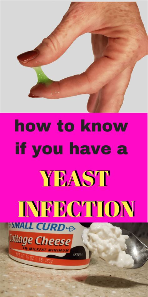 How To Effectively Treat A Yeast Infection Diana In The Pink