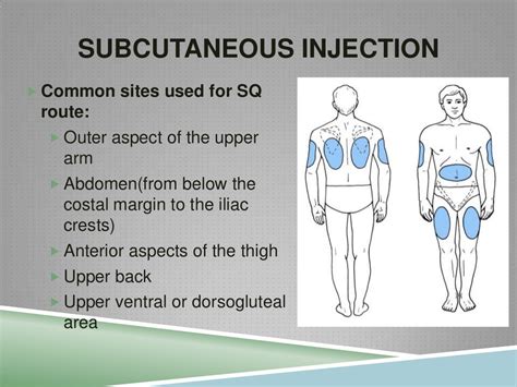 Insulin Injection Sites Diagram Printable - prntbl ...