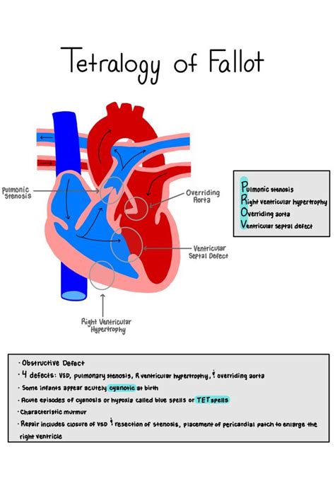 Tetralogy Of Fallot Medical School Stuff Nursing School Survival Nursing School Notes