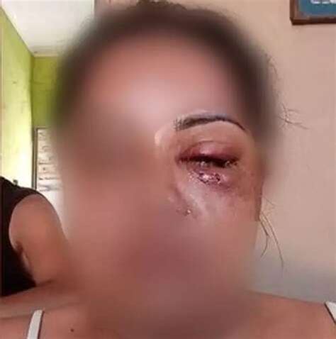 Diarista pede ajuda à vizinha após ser agredida e estuprada por