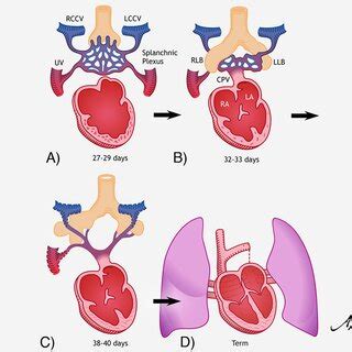 Embryology of the normal pulmonary venous system. CPV common pulmonary ...