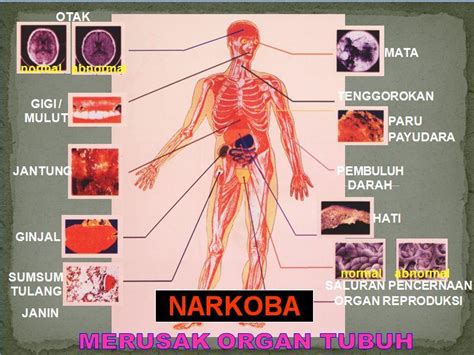 Informasi Narkoba Membahayakan Kesehatan Dan Menyebabkan Gangguan