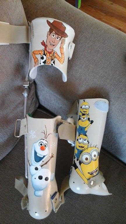 Minion Leg Cast Artofit