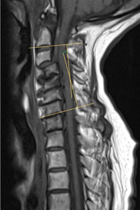 Magnetic Resonance Imaging Techniques For The Evaluation Of The