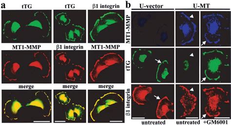 Colocalization Of TTG And 1 Integrins With MT1 MMP Panel A Both